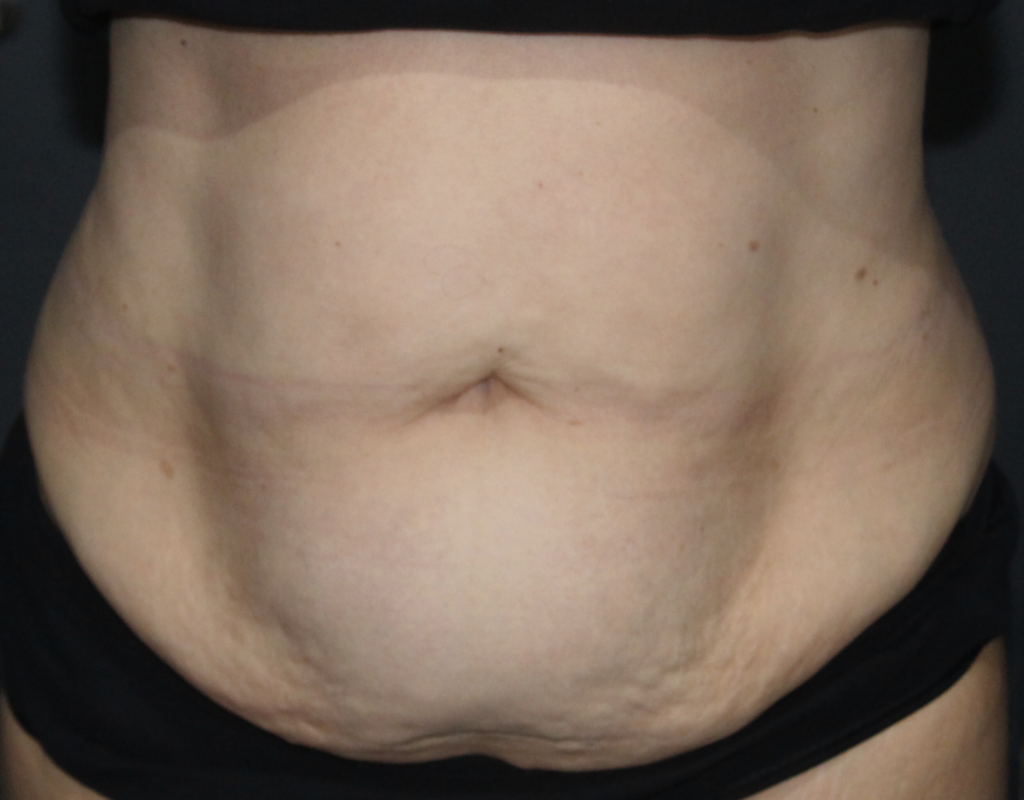 Emerald Clinic - case 2 after
