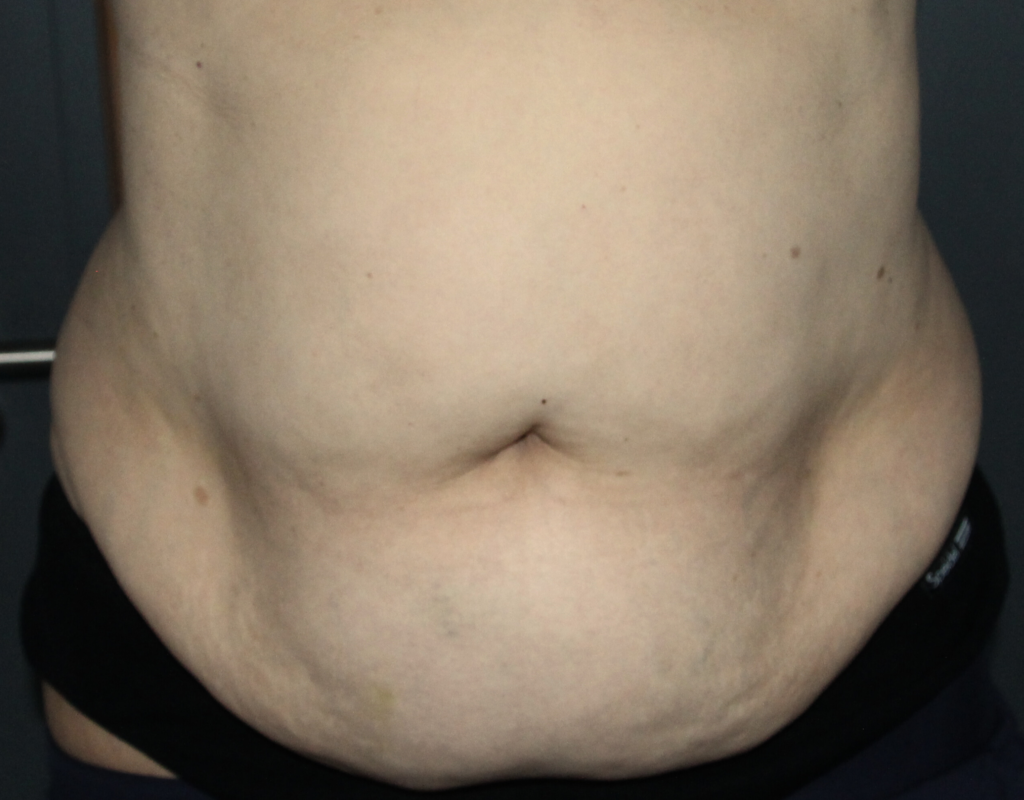 Emerald Clinic - case 2 before
